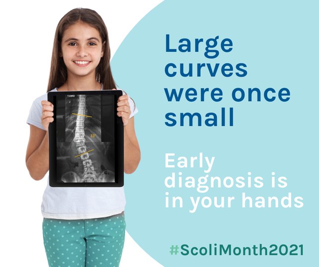 scoliosis month